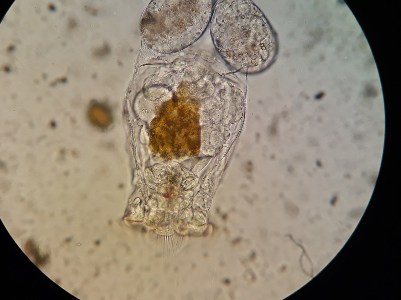 Brachionus sp Brachionus sp